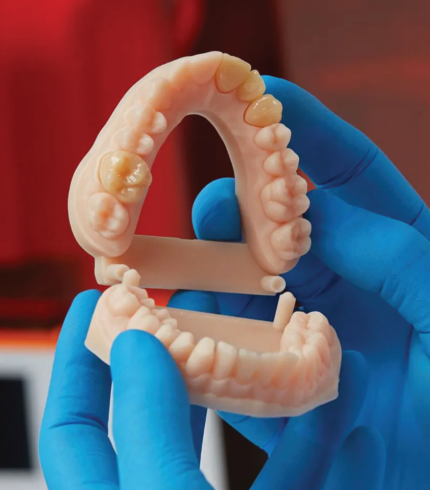 Rendu grâce à la résine Dental Model V3 de la marque Formlabs