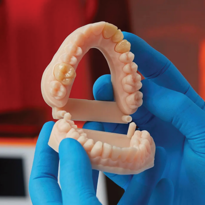 Rendu grâce à la résine Dental Model V3 de la marque Formlabs