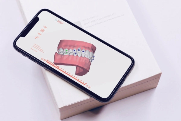 DEEPviewer, un outil permettant au patient de mieux appréhender son traitement.