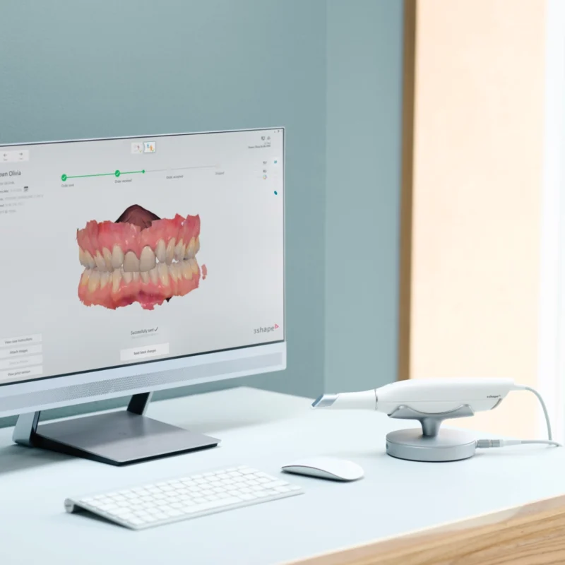 Le rendu sur ordinateur du scan intra-oral avec la TRIOS Core de la marque 3Shape