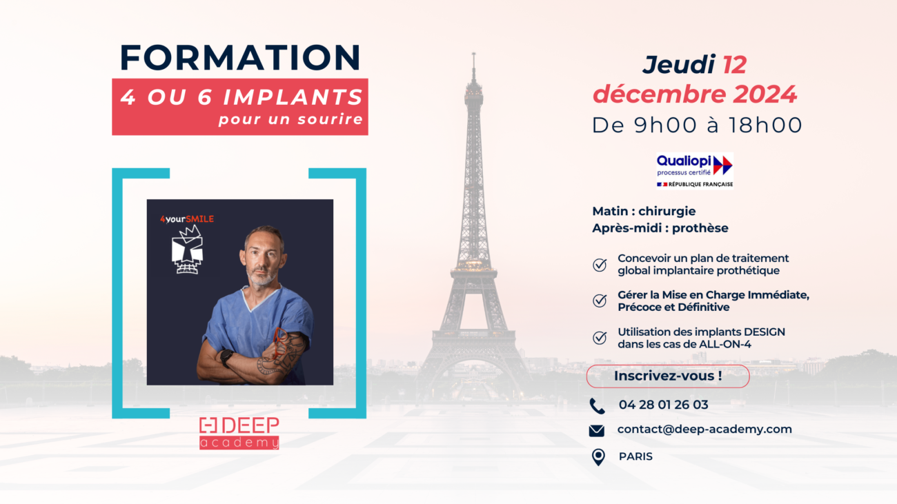 Le visuel de la formation 4 ou 6 implants pour un sourire